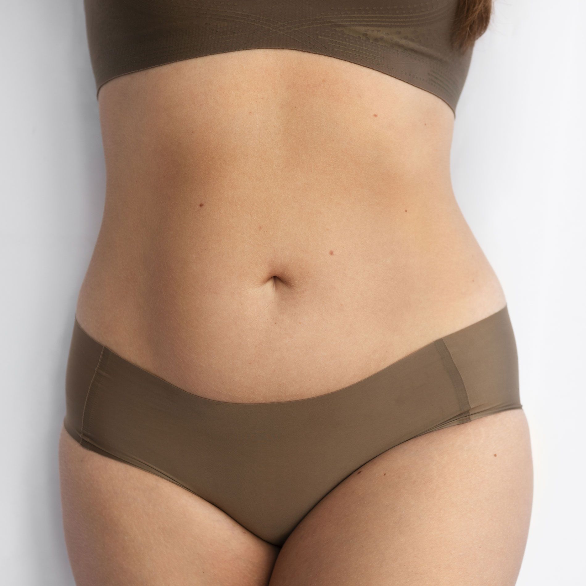 Tummy Tuck or Abdominoplasty - Body Sculpt California