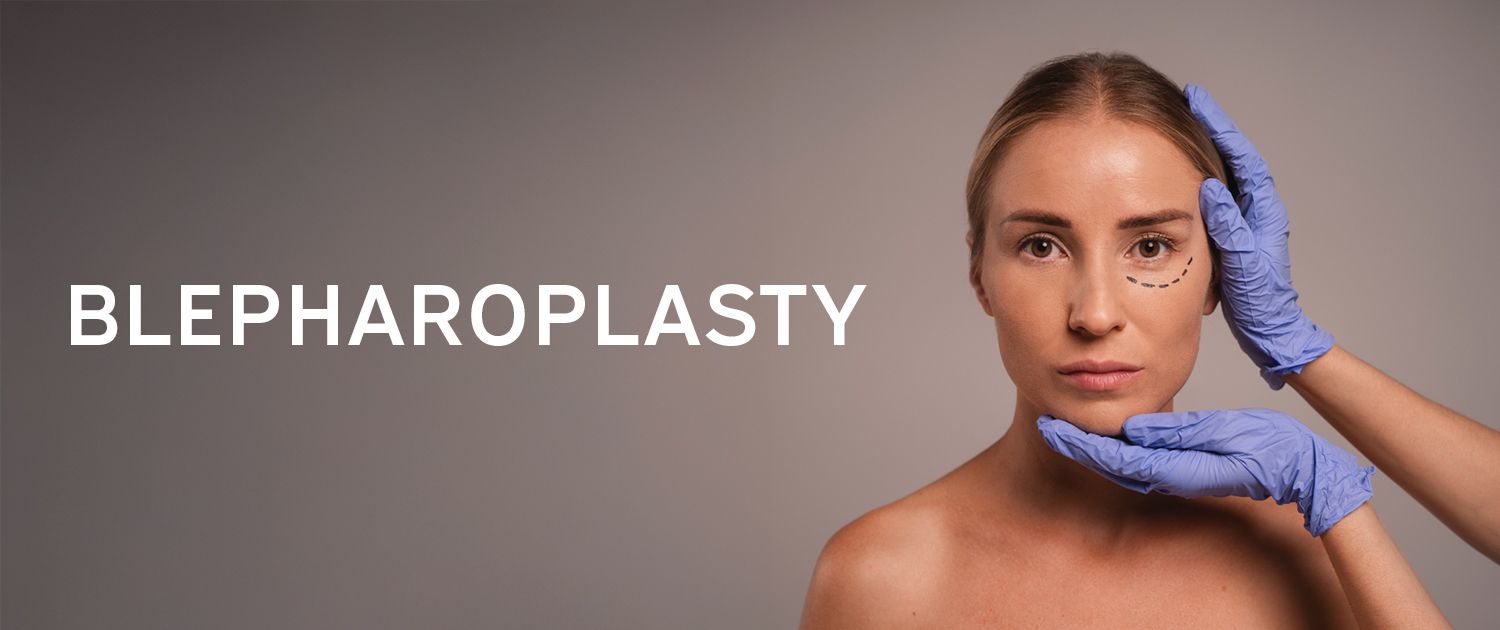 Blepharoplasty - Body Sculpt California