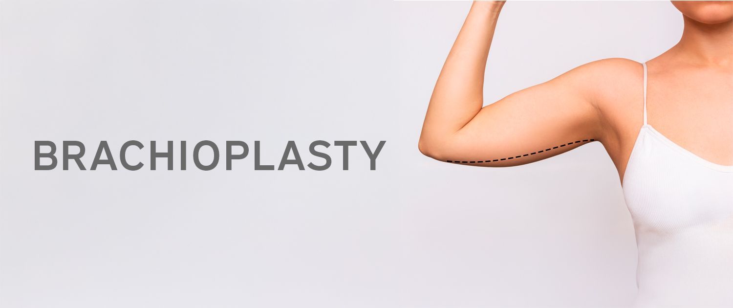 Brachioplasty - Body Sculpt California Brachioplasty - Body Sculpt California