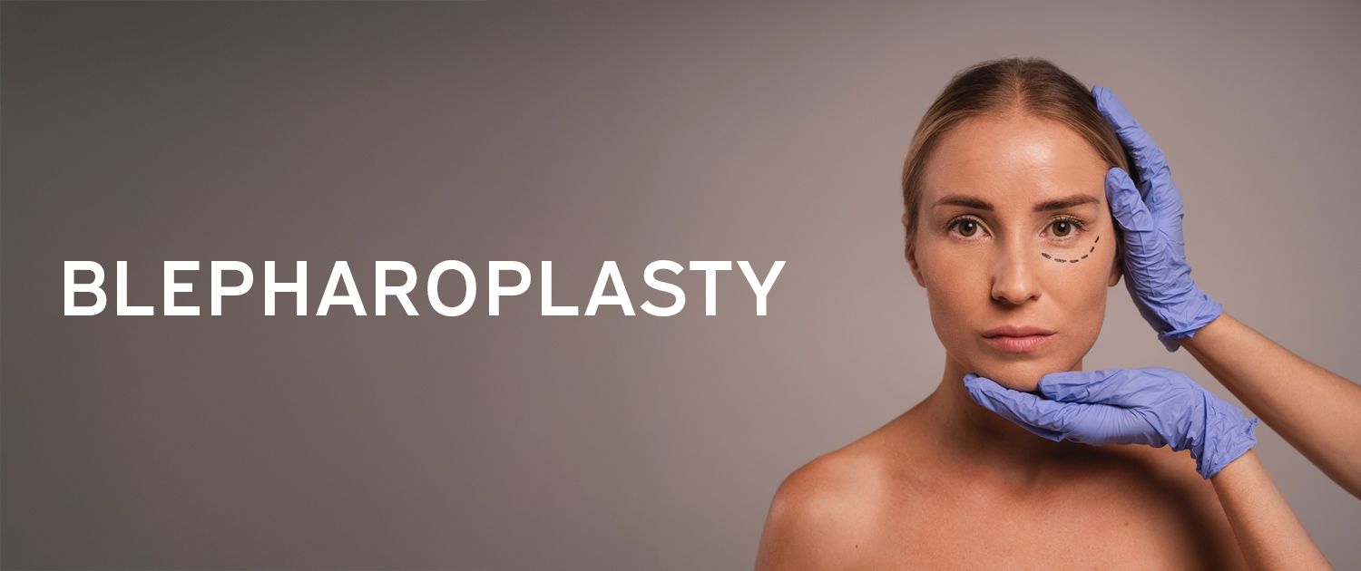 Blepharoplasty - Body Sculpt California